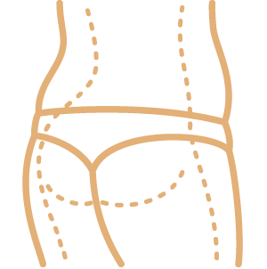 Inkless Stretch Mark Revision